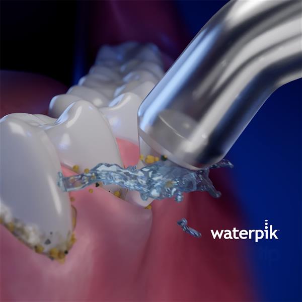Classic Pik Pocket™ Water Flosser Tip PP-70E | Replacement Tips - Image 3